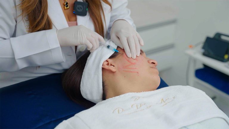 Dra. Arroyo – Exosomas en Cicatrices Acné