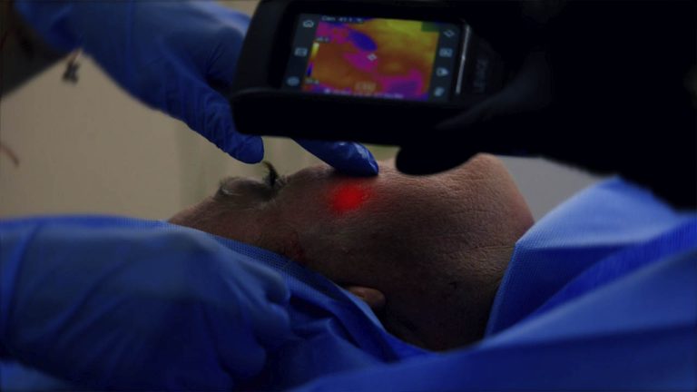 Dra. Beatriz Lam 05 – Láser Endodérmico